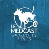 Episode 13: Holes