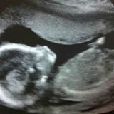 Daughter Dubstep Mix