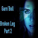 Broken Leg Techno . Part 2