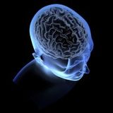 MindShock - Neurological Sympathies