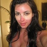 Strange Sunburns