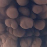 Mammatus Clouds