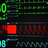Heartbeat Machine