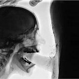 Deepthroat