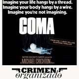 CO-33-Coma