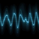 010315 Open Eye Signal