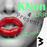 KNent & XLRR Presents We Are Episode 3