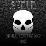 Skull Tech Radio 005
