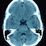 sWinging in the Brain!