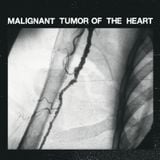 Malignant Tumor Of The Heart
