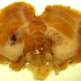 Cerebellum