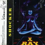 X-Ray - SHOCKER... 1995