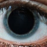 Dilate Eyeball Mix