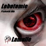 Lobotomie