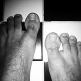 Bare Foot Summer