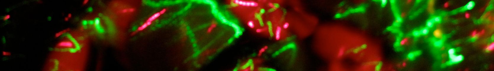 Mixcloud banner for @commonwealth