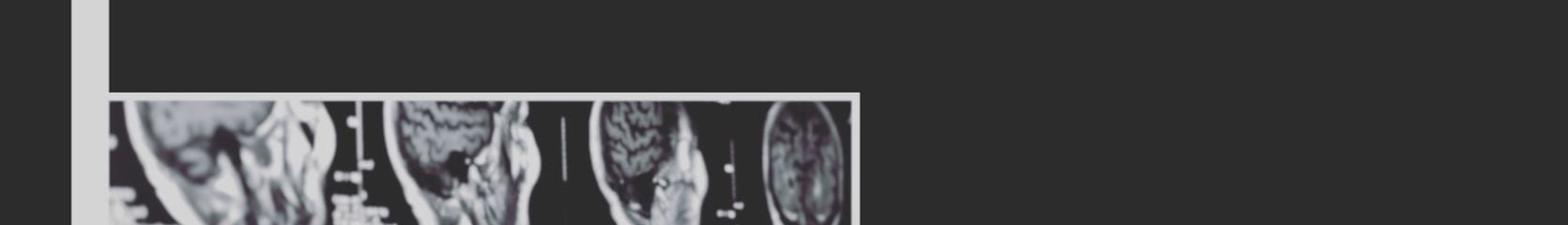 Mixcloud banner for @Neurology