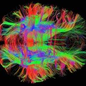 Synthesized senses