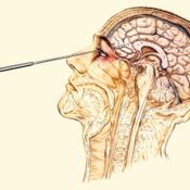 Brain Lobotomy (DeadLift mix)
