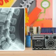 20AUG25 | Slipped Discs