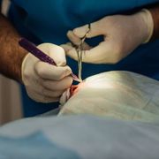 Does the Removal of Sutures Hurt? CPT Codes & ICD-10 Guide - Audio Blog