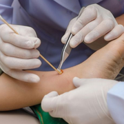 Discovering Iodoform Gauze Packing Strips for Wound Dressing - Audio Blog