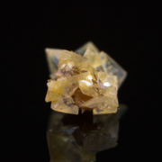 What Are Uric Acid Kidney Stones, and What Causes a Urate Stone? - Audio Blog