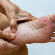 What Does Plantar Fasciitis Feel Like and How Long Does It Last for Most Patients? - Audio Blog