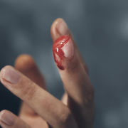 How to Treat a Skin Avulsion Finger Wound: Step-By-Step Guide With Pictures - Audio Blog