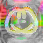 CMR183 - Sebastian Markiewicz - NFT