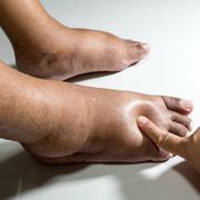 What Are the 5 Main Symptoms of Diabetic Neuropathy? A Complete Guide - Audio Blog
