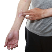 Top Pointers To Finding Out If Itching Is a Sign of Wound Healing or Infection - Audio Blog
