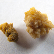 What Are Struvite Kidney Stones in Urine? Uncover Struvite Stone Composition, Causes and Treatment