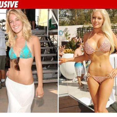 Jazcast: Heidi Montag Sex Tape -- Pre and Post-Op by Jazcast | Mixcloud