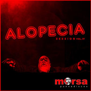 Alopecia 4