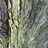 retinaltear