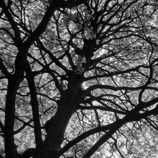 Boreal