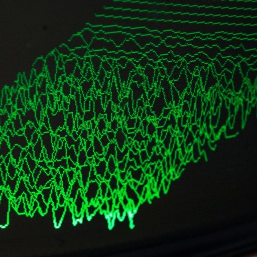 Instrumental Instruments – The Fairlight