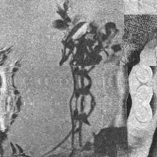 Melody and Concrete with Kali Louise (04/07/2018)