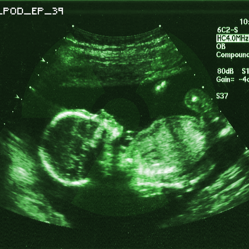Nuclear Stomach Babies