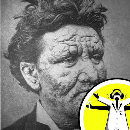 Leprosy: The Low Down