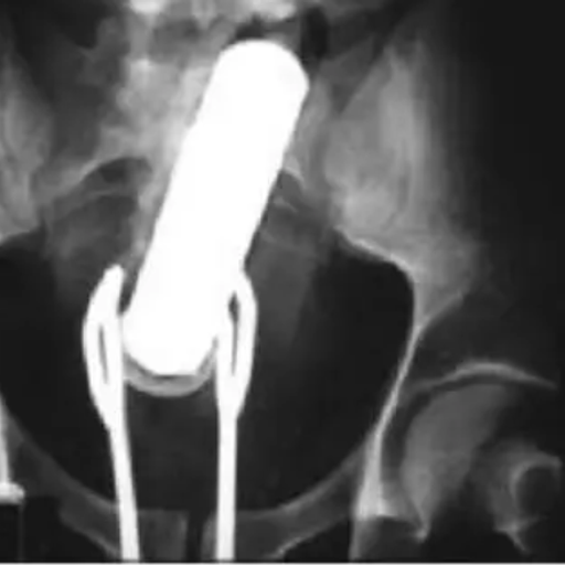 מורידים את הרף 30 - ירון חכם יובל יוספסון - 8.1.19