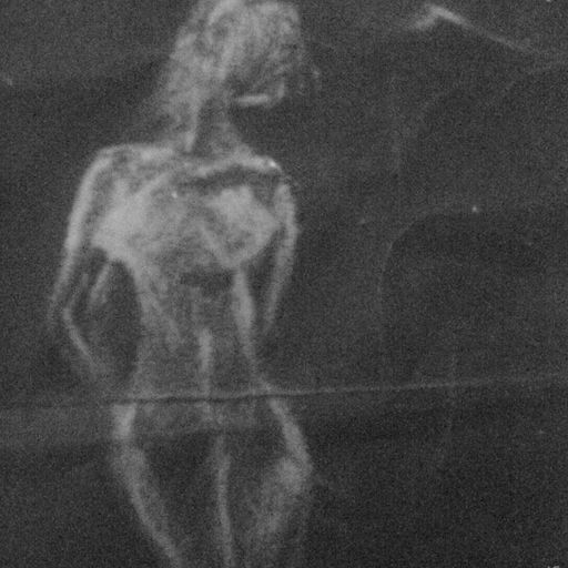 resistance from absorbian legions