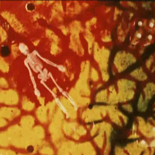 Headshrinker (Psych Mix 2)
