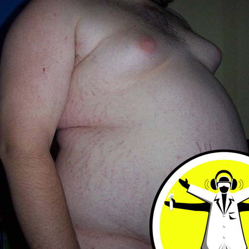 Obesity in your Genes