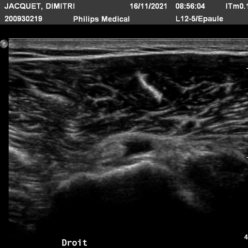 acid mix by d-jack-15Nov-2021