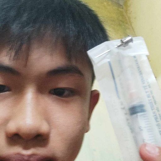 Nhạc  Anh Là Phải Chích