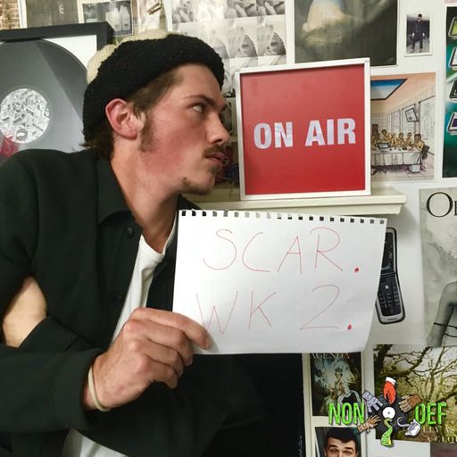 NONDEF S.C.A.R. Wk2 With Alfie