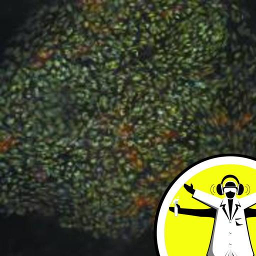 From Stem Cells to Brain Cells
