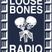 Loose Bones - 24th April 2017